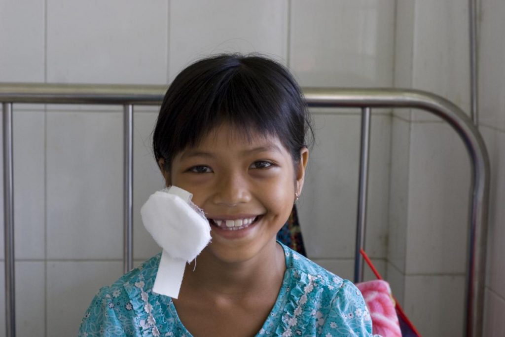 Financing for universal eye health: 8 Reflections on UHC