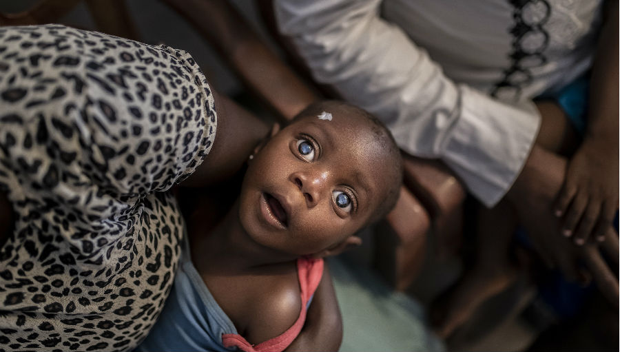 Potrait-of-a-child-with-double-cataracts