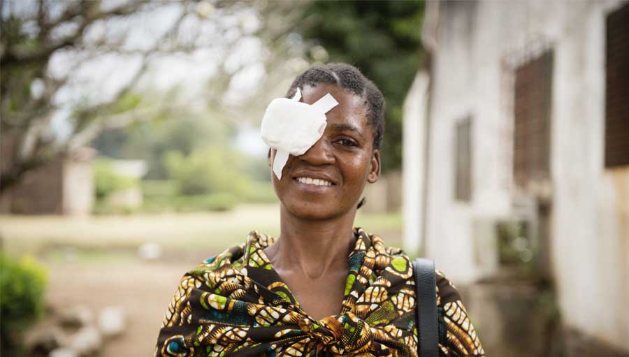 Suzanna, 34 years of age was pleased after receiving surgery for bilateral cataract
