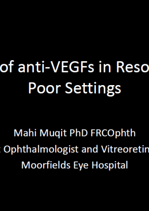 Use of anti-VEGFs in Resource Poor Settings - Mahi Muqit