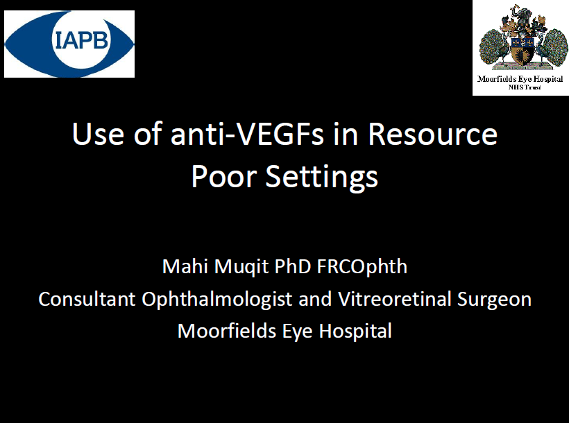 Use of anti-VEGFs in Resource Poor Settings - Mahi Muqit