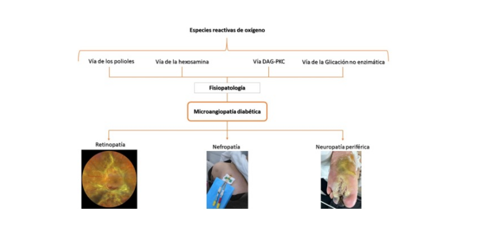 Microangiopatía - Síntomas y causas - Mayo Clinic