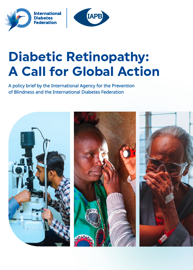 Diabetic Retinopathy: A Call for Global Action