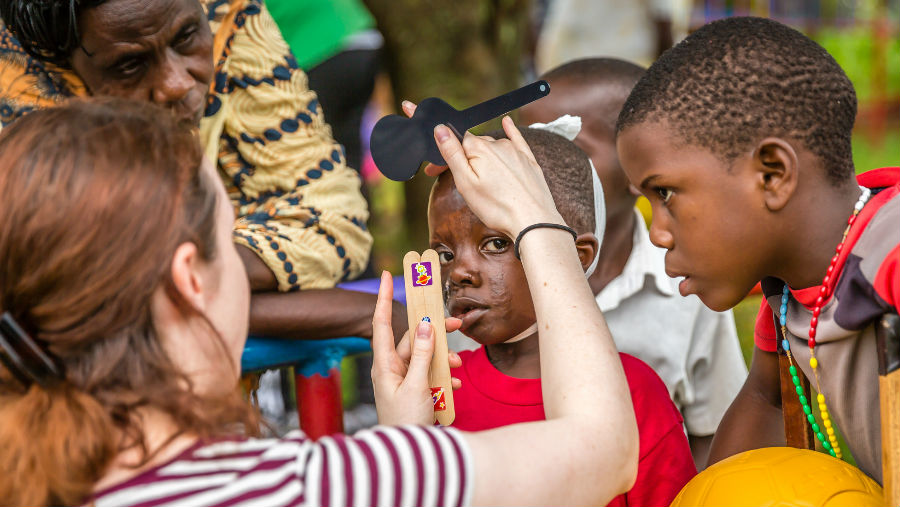 Orthoptist checking visual acuity of child burnt as a result of falling into cooking fire/ Terry Cooper/ Story: Blindness in children: declining magnitude over time