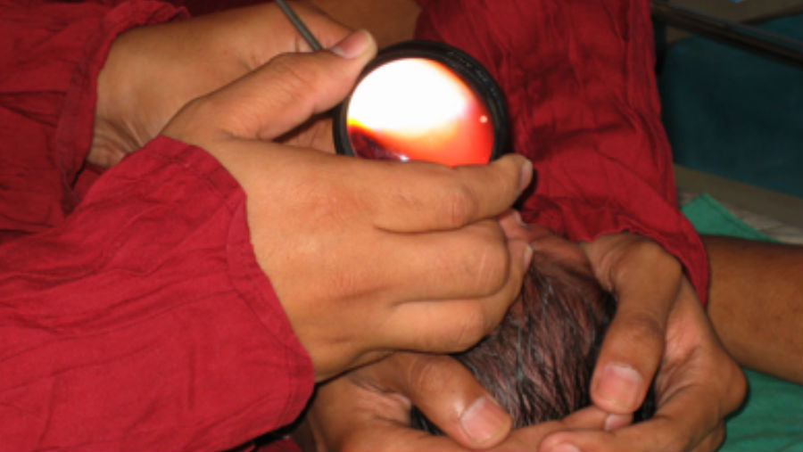 Integrating ROP into neonatal care, Image: Premature baby being examined by an ophthalmologist being trained in ROP screening in a neonatal intensive care unit in Nashik, Maharashtra