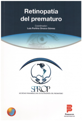 Retinopatía del Prematuro