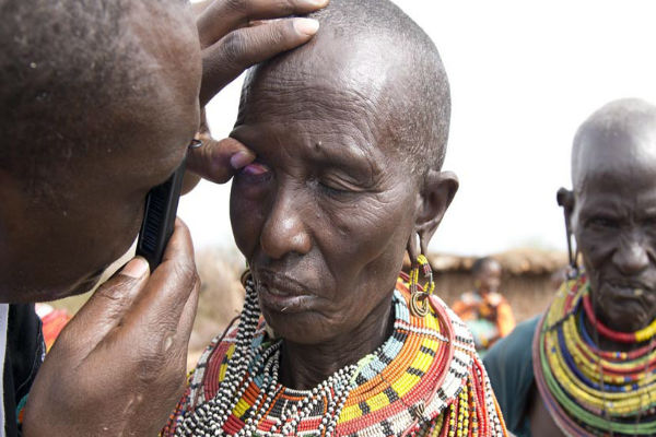 Trachoma examination