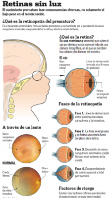 Retinas sin luz